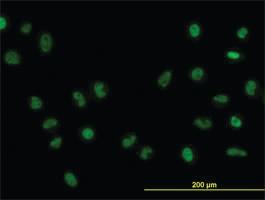 Anti-FOXA1 Mouse Monoclonal Antibody [clone: 3C1]