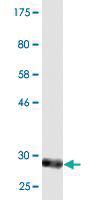 Anti-EML4 Mouse Monoclonal Antibody [clone: 2F2]