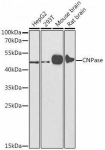 Western blot analysis of extracts of various cell lines, using Anti-CNPase Antibody (A308860) at 1:1,000 dilution. The secondary antibody was Goat Anti-Rabbit IgG H&L Antibody (HRP) at 1:10,000 dilution.