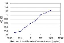 Anti-PRKAR2A Mouse Monoclonal Antibody [clone: 6A9]