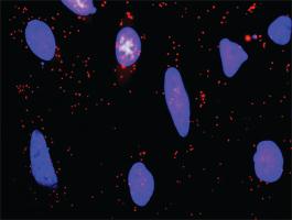 Anti-BTC + ERBB2 Antibody Pair