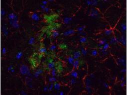 RB anti-beta Amyloid 100 μg