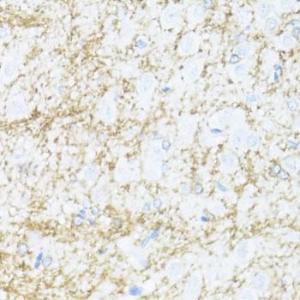 Immunohistochemistry analysis of paraffin-embedded rat brain using Anti-CNPase Antibody (A308860) at a dilution of 1:100 (40x lens). Perform microwave antigen retrieval with 10 mM PBS buffer pH 7.2 before commencing with IHC staining protocol.