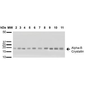 Western blot analysis of human A431, HCT116, HeLa, HepG2, HEK293, HUVEC, Jurkat, MCF7, PC3 and T98G cel