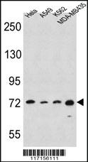 Anti-RNF19A Rabbit Polyclonal Antibody