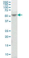 Anti-SMAD3 Mouse Monoclonal Antibody [clone: 4D5]