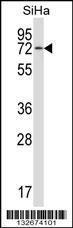 Anti-HSPA12B Rabbit Polyclonal Antibody (Biotin)