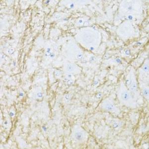 Immunohistochemistry analysis of paraffin-embedded mouse spinal cord using Anti-CNPase Antibody (A308860) at a dilution of 1:100 (40x lens). Perform microwave antigen retrieval with 10 mM PBS buffer pH 7.2 before commencing with IHC staining protocol.