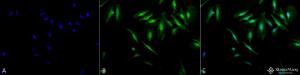 Immunocytochemistry/Immunofluorescence analysis of human heat shocked cervical cancer cell line (HeLa), fixed in 2% formaldehyde for 20 minutes at room temperature, using Anti-alpha B Crystallin Antibody (A304739), at 1:120 for 12 hours at 4°