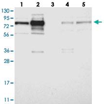 Anti-GRAMD1C Rabbit Polyclonal Antibody