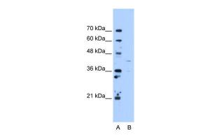 Anti-OAT Rabbit Polyclonal Antibody