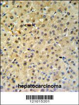 Anti-PSME1 Rabbit Polyclonal Antibody (Biotin)