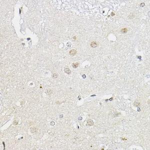 Immunohistochemistry analysis of paraffin-embedded human brain tissue using Anti-RING1 Antibody (A305946) at a dilution of 1:100 (40x lens). Perform high pressure antigen retrieval with 10 mM citrate buffer pH 6.0 before commencing with IHC staining protocol.