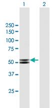 Anti-PRKAR2B Mouse Polyclonal Antibody