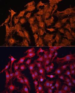 Immunofluorescence analysis of C6 cells using Anti-P Glycoprotein Antibody (A11432) at a dilution of 1:100. DAPI was used to stain the cell nuclei (blue)