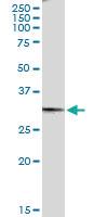 Anti-GGPS1 Rabbit Polyclonal Antibody