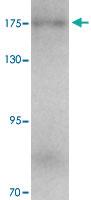 Anti-KIAA0196 Rabbit Polyclonal Antibody