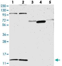 Anti-MRPL52 Rabbit Polyclonal Antibody