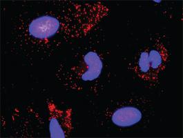 Anti-TGFA + ERBB2 Antibody Pair