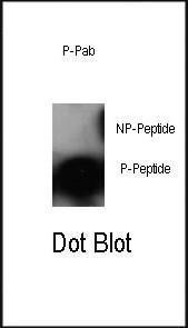 Anti-JUN Rabbit Polyclonal Antibody (AP (Alkaline Phosphatase))