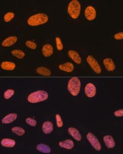 Immunofluorescence analysis of U-2 OS cells using Anti-SAM68 Antibody [ARC0858] (A307676) at a dilution of 1:100 (40x lens) DAPI was used to stain the cell nuclei (blue)