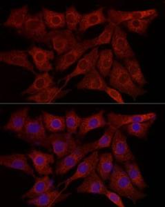 Anti-SYPL1 Rabbit Polyclonal Antibody