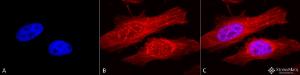 Immunocytochemistry/Immunofluorescence analysis of human heat shocked cervical cancer cell line (HeLa), fixed in 2% formaldehyde for 20 minutes at room temperature, using Anti-alpha B Crystallin Antibody (A304739), at 1:120 for 12 hours at 4°