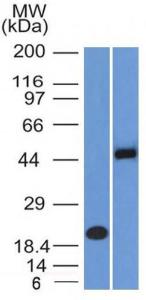 Western blot analysis of (A) recombinant PAX8 protein and (B) Raji cell lysate using Anti-PAX8 Antibody [PAX8/1492]