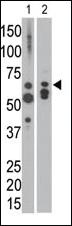 Anti-MTM1 Rabbit Polyclonal Antibody