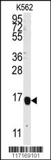 Anti-TOM1L1 Rabbit Polyclonal Antibody