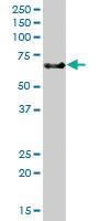 Anti-TNFRSF21 Mouse Polyclonal Antibody