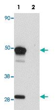 Anti-SCRN1 Rabbit Polyclonal Antibody