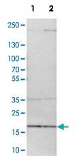 Anti-MRPL52 Rabbit Polyclonal Antibody