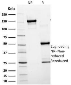 Antibody anti-GFAP SPM248 100 µg