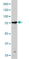 Anti-PRKCA Mouse Monoclonal Antibody [clone: 2F11]