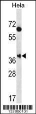 Anti-MBNL2 Rabbit Polyclonal Antibody (Biotin)