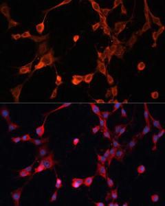 Immunofluorescence analysis of NIH/3T3 cells using Anti-P Glycoprotein Antibody (A11432) at a dilution of 1:100. DAPI was used to stain the cell nuclei (blue)