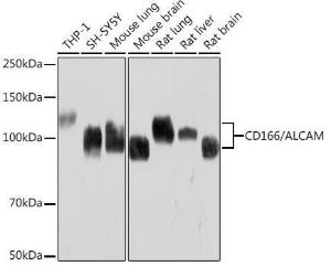 Western blot analysis of extracts of various cell lines, using Anti-CD166 Antibody [ARC1720] (A308864) at 1:1,000 dilution