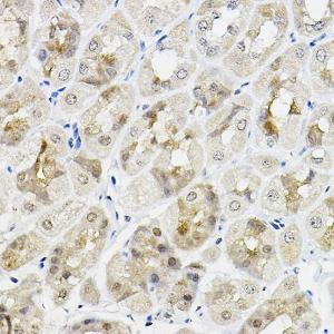 Immunohistochemistry analysis of paraffin-embedded mouse stomach using Anti-RING1 Antibody (A305946) at a dilution of 1:100 (40x lens). Perform high pressure antigen retrieval with 10 mM citrate buffer pH 6.0 before commencing with IHC staining protocol.