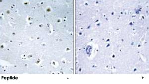 Anti-TUBGCP3 Rabbit Polyclonal Antibody