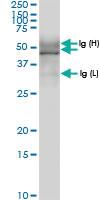 Anti-TUBD1 Rabbit Polyclonal Antibody