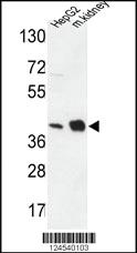 Anti-NDUFA10 Rabbit Polyclonal Antibody