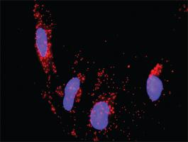 Anti-PTK2B + ERBB2 Antibody Pair