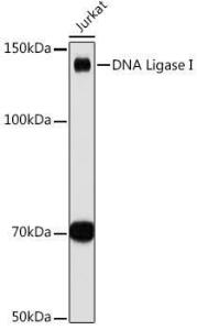 Western blot analysis of extracts of Jurkat cells, using Anti-LIG1 Antibody [ARC1514] (A307677) at 1:1,000 dilution. The secondary antibody was Goat Anti-Rabbit IgG H&L Antibody (HRP) at 1:10,000 dilution.