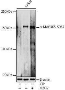 Western blot analysis of extracts of Jurkat cells, using Anti-ASK1 (phospho Ser967) Antibody (A309782) at 1:1,000 dilution Jurkat cells were treated by CIP(20uL/400ul) at 37°C for 1 hour Jurkat cells were treated by Hydrogen Peroxide (2 mM) at 37°C for 2 minutes after serum-starvation overnight