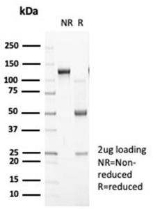 SDS-PAGE analysis of Anti-N Cadherin Antibody [CDH2/7070R] under non-reduced and reduced conditions; showing intact IgG and intact heavy and light chains, respectively. SDS-PAGE analysis confirms the integrity and purity of the antibody