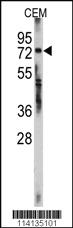 Anti-ZNF219 Rabbit Polyclonal Antibody