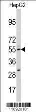 Anti-CYP11A1 Rabbit Polyclonal Antibody