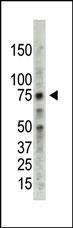 Anti-PRMT5 Rabbit Polyclonal Antibody (Biotin)