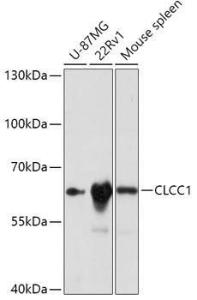 Western blot analysis of extracts of various cell lines, using Anti-CLCC1 Antibody (A305947) at 1:1,000 dilution